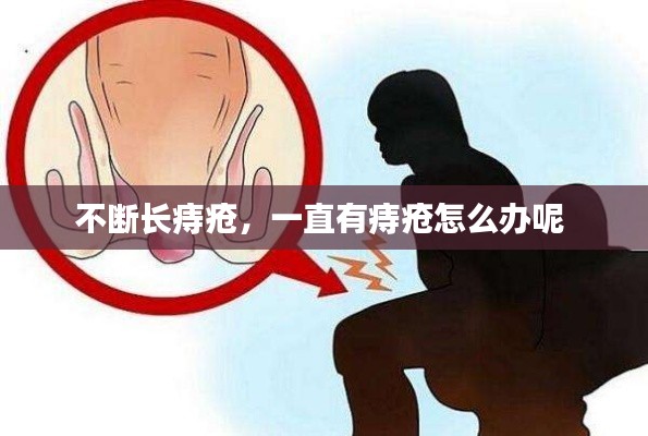 不断长痔疮,一直有痔疮怎么办呢